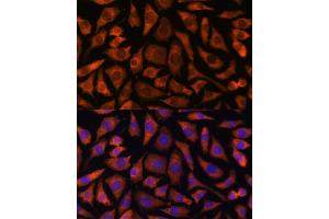 Immunofluorescence analysis of L929 cells using RABGGTA antibody (ABIN7269783) at dilution of 1:100. (RABGGTA 抗体  (AA 240-360))