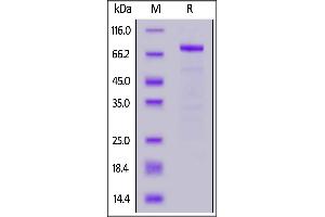 SDS-PAGE (SDS) image for Interleukin 11 Receptor, alpha (IL11RA) (AA 24-370) (Active) protein (Fc Tag) (ABIN6992343)