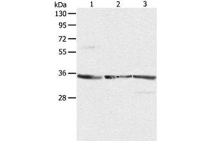 Western Blot analysis of NIH/3T3, A431 and Jurkat cell using RPLP0 Polyclonal Antibody at dilution of 1:750 (RPLP0 抗体)
