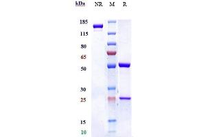 Anti-IL-5 Reference Antibody (mepolizumab) on SDS-PAGE under reducing (R) condition. (Recombinant IL5 (Mepolizumab Biosimilar) 抗体)
