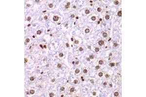 Immunohistochemistry of paraffin-embedded mouse liver using SSRP1 antibody. (SSRP1 抗体  (AA 1-300))