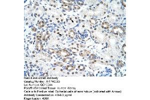 Rabbit Anti-LSM2 Antibody  Paraffin Embedded Tissue: Human Kidney Cellular Data: Epithelial cells of renal tubule Antibody Concentration: 4. (LSM2 抗体  (Middle Region))