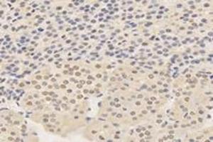 Immunohistochemistry analysis of paraffin-embedded rat adrenal gland using,TPRKB (ABIN7075943) at dilution of 1: 4200 (TPRKB 抗体)