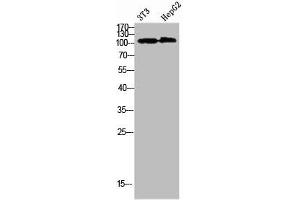 Western Blot analysis of 3T3 HEPG2 cells using Collagen alpha-1(XXVIII)Polyclonal Antibody diluted at 1:1000. (COL28A1 抗体  (AA 111-160))