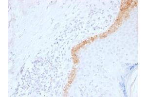 Formalin-fixed, paraffin-embedded human Skin stained with Cytokeratin 15 Mouse Monoclonal Antibody (LHK15). (KRT15 抗体  (C-Term))