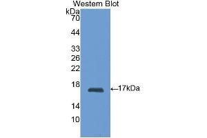 Western blot analysis of the recombinant protein. (RBP1 抗体  (AA 2-135))