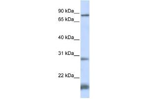 WB Suggested Anti-SMYD4 Antibody Titration:  0. (SMYD4 抗体  (N-Term))