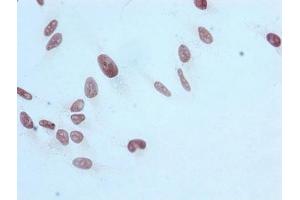 Immunocytochemistry analysis of ABIN7127303 diluted at 1:100 and staining in Hela cells performed on a Leica BondTM system. (Recombinant HIST1H3A 抗体  (H3R17me))