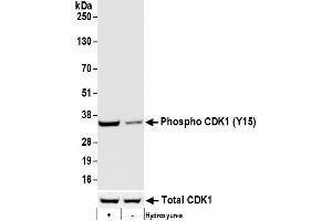 Western Blotting (WB) image for anti-Cyclin-Dependent Kinase 1 (CDK1) (pTyr15) antibody (ABIN7452577)