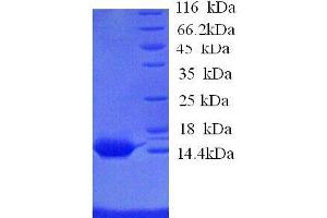 SDS-PAGE (SDS) image for Serum Amyloid A1 (SAA1) (AA 1-110), (full length) protein (His tag) (ABIN7478942)