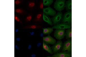 ABIN6259857 and ABIN6266711 staining  cells by IF/ICC.