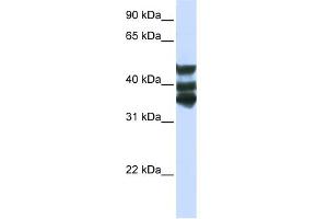 WB Suggested Anti-HGD Antibody Titration:  0. (HGD 抗体  (Middle Region))