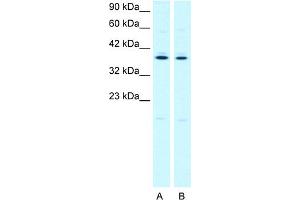 Western Blotting (WB) image for anti-Prostaglandin E Receptor 3 (Subtype EP3) (PTGER3) (C-Term) antibody (ABIN2778264)