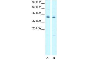 WB Suggested Anti-PTGER3 Antibody Titration:  2. (PTGER3 抗体  (C-Term))