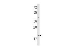 Western blot analysis of IL12A Antibody (C-term) (ABIN652744 and ABIN2842492) in MDA-M cell line lysates (35 μg/lane). (IL12A 抗体  (C-Term))