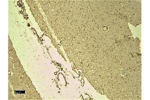 Immunohistochemistry (IHC) image for anti-Sodium Channel, Voltage-Gated, Type V, alpha Subunit (SCN5A) (Internal Region) antibody (ABIN185467)