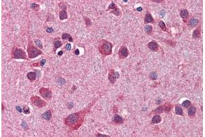 Human Brain, Cortex: Formalin-Fixed, Paraffin-Embedded (FFPE) (ATG12 抗体  (AA 79-128))