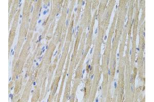 Immunohistochemistry of paraffin-embedded rat heart using P2RY2 antibody (ABIN6293436) at dilution of 1:100 (40x lens). (P2RY2 抗体)