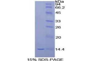 SDS-PAGE analysis of Rat MIP1g Protein. (CCL9 蛋白)