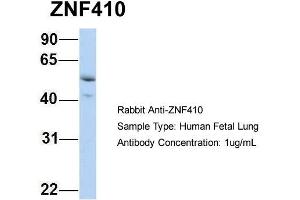 Host: Rabbit Target Name: ZNF410 Sample Type: Human Fetal Lung Antibody Dilution: 1.