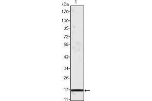 Western blot analysis using MCP1 mouse mAb against truncated MCP-1 recombinant protein. (CCL2 抗体)