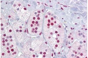 Anti-ROR Alpha antibody IHC staining of human adrenal. (RORA 抗体  (AA 36-85))