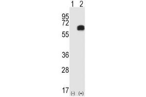 Western blot analysis of RIPK2 antibody and 293 cell lysate either nontransfected (Lane 1) or transiently transfected (2) with the RIPK2 gene. (RIPK2 抗体  (AA 458-488))