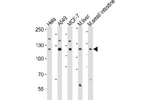 Western blot analysis of lysates from Hela, A549, MCF-7 cell line, mouse liver, mouse small intestine tissue lysate(from left to right), using ZN Antibody (Center) (ABIN6242706 and ABIN6577885). (ZNF281 抗体  (AA 416-450))