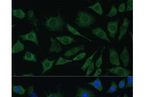 Immunofluorescence (IF) image for anti-Bone Morphogenetic Protein Receptor, Type IB (BMPR1B) antibody (ABIN7260047)