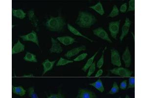 Immunofluorescence analysis of L929 cells using BMPR1B Polyclonal Antibody at dilution of 1:100. (BMPR1B 抗体)