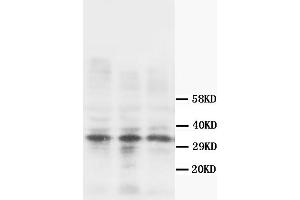 Western Blotting (WB) image for anti-Calponin 1 (CNN1) antibody (ABIN1105641) (CNN1 抗体)