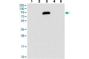 Western blot analysis of Lane 1: RT-4, Lane 2: U-251 MG, Lane 3: Human Plasma, Lane 4: Liver, Lane 5: Tonsil with IGFALS polyclonal antibody  at 1:250-1:500 dilution. (IGFALS 抗体)