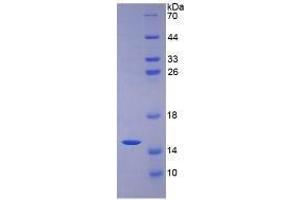 SDS-PAGE analysis of Human Mucin 2 Protein. (MUC2 蛋白)