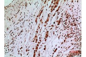Immunohistochemistry (IHC) analysis of paraffin-embedded Human Brain, antibody was diluted at 1:100. (SAMHD1 抗体  (Internal Region))