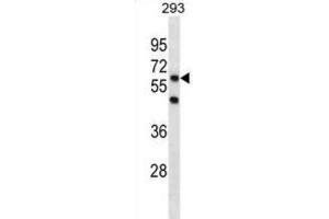 Western Blotting (WB) image for anti-PiggyBac Transposable Element Derived 3 (PGBD3) antibody (ABIN3001306) (PGBD3 抗体)