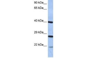 Western Blot showing CIDEB antibody used at a concentration of 1-2 ug/ml to detect its target protein. (CIDEB 抗体  (Middle Region))