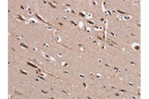 The image on the left is immunohistochemistry of paraffin-embedded Human brain tissue using ABIN7131459(TRAFD1 Antibody) at dilution 1/20, on the right is treated with fusion protein. (TRAFD1 抗体)