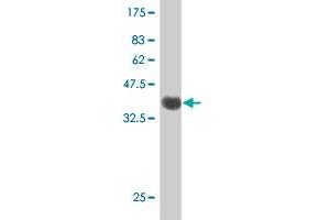 Western Blot detection against Immunogen (38. (PDXK 抗体  (AA 51-160))