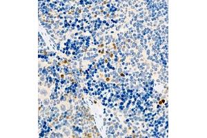 Immunohistochemistry (Paraffin-embedded Sections) (IHC (p)) image for anti-Chemokine (C-C Motif) Ligand 3 (CCL3) antibody (ABIN7073450)