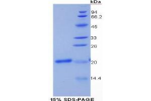 SDS-PAGE analysis of Human Collagen Type XV Protein. (COL15 蛋白)