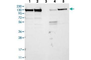 Western blot analysis of Lane 1: RT-4, Lane 2: U-251 MG, Lane 3: Human Plasma, Lane 4: Liver, Lane 5: Tonsil with MATR3 polyclonal antibody  at 1:250-1:500 dilution. (MATR3 抗体)
