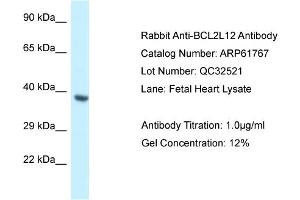 Western Blotting (WB) image for anti-BCL2-Like 12 (Proline Rich) (BCL2L12) (Middle Region) antibody (ABIN2788895) (BCL2L12 抗体  (Middle Region))