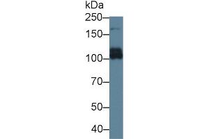 Detection of ABCC6 in Rat Liver lysate using Polyclonal Antibody to ATP Binding Cassette Transporter C6 (ABCC6) (ABCC6 抗体  (AA 1260-1502))