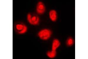 Immunofluorescent analysis of DUSP16 staining in COLO205 cells. (DUSP16 抗体  (C-Term))