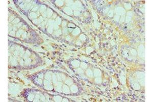 Immunohistochemistry of paraffin-embedded human colon tissue using ABIN7172503 at dilution of 1:100 (DP1 抗体  (AA 1-290))