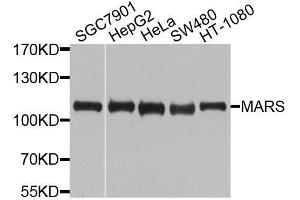Western blot analysis of extracts of various cell lines, using MARS antibody. (Mars (MARS) (AA 1-270) 抗体)