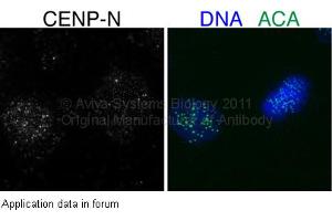 Image no. 1 for anti-Centromere Protein N (CENPN) (Middle Region) antibody (ABIN2787136) (CENPN 抗体  (Middle Region))