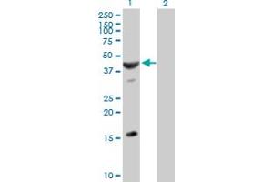 Western Blot analysis of ASB6 expression in transfected 293T cell line by ASB6 MaxPab polyclonal antibody. (ASB6 抗体  (AA 1-421))