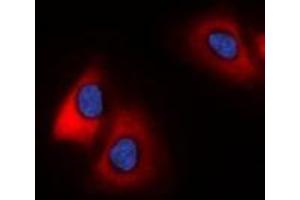 Immunofluorescent analysis of 42431 staining in HeLa cells. (MARCH2 抗体  (C-Term))