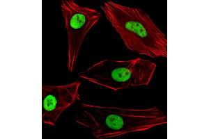 Fluorescent image of SH-SY5Y cells stained with SUMO2/3 Antibody (C-term) (ABIN388034 and ABIN2845512). (SUMO2/3 抗体  (C-Term))